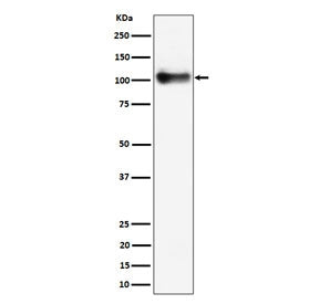 Western blot testing of mouse lung tissue lysate with Thbd antibody. Expected molecular weight ~60/1