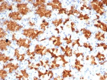 IHC staining of FFPE human stomach tissue with Interleukin-2 antibody (clone IL2/4985). HIER: boil t