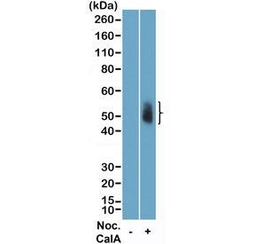 Phospho-Aurora A/B/C Antibody (pThr288/pThr232/pThr198)