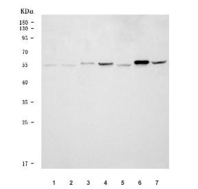 Western blot testing of 1) human U-87 MG, 2) human ThP-1, 3) human HL60, 4) rat pancreas, 5) rat tes