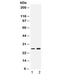 Western blot testing of 1) rat testis and 2) human MCF7 lysate with PSMA2 antibody at 0.5ug/ml. Pred
