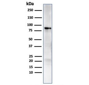 Western blot testing of human MCF7 cell lysate with HSP90AB1 antibody. Expected molecular weight: 84