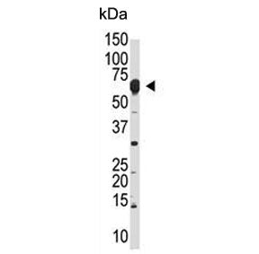 Western blot testing of mouse liver lysate with NUB1 antibody. Expected molecular weight: 70-100 kDa