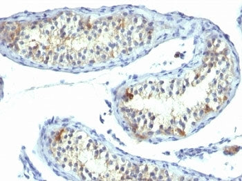 Prolactin Receptor Antibody / PRLR