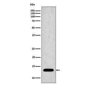 Profilin 1 Antibody