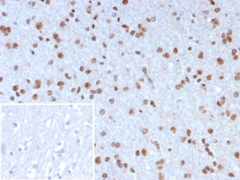 IHC staining of FFPE human brain tissue with NEUROG3 antibody (clone NGN3/7698) Inset: PBS used in p