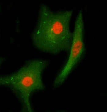 Immunofluorescent staining of FFPE human A549 cells with Checkpoint kinase 2 antibody (red) and Beta