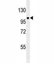 ZEB1 Antibody