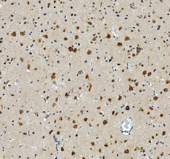 IHC staining of FFPE human brain tissue with RPL19 antibody, HRP-secondary and DAB substrate. HIER: 