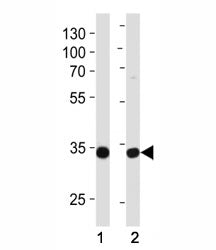 Western blot analysis of lysate from (1) MCF-7 and (2) NCI-H460 cell line using TAZ antibody at 1:10