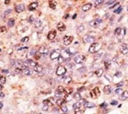 ABCB7 Antibody