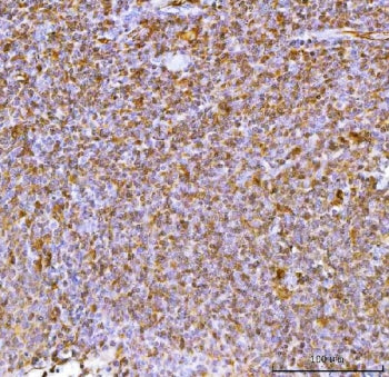 IHC staining of FFPE human tonsil tissue with Interleukin 34 antibody. HIER: boil tissue sections in
