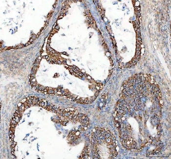 ATP1A1 Antibody
