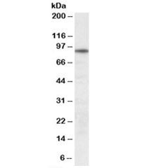 Western blot testing of human skeletal muscle lysate with UNC45B antibody at 0.3ug/ml. Predicted mol