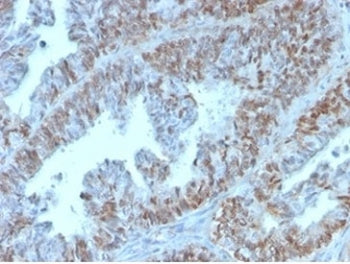 IHC staining of FFPE human colon tissue with PAX2 antibody (clone PAX2/1105). HIER: boil tissue sect