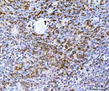IHC staining of FFPE human tonsil tissue with TRAILR2 antibody. HIER: boil tissue sections in pH8 ED