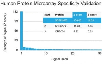 SERPINB3 Antibody / SCCA-1