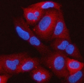 Immunofluorescent staining of FFPE human A549 cells with RAP1GAP antibody (red) and DAPI nuclear sta
