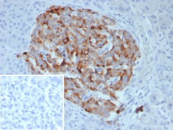 Chromogranin B Antibody / Secretogranin I