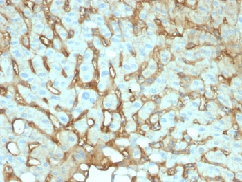 Albumin Antibody / ALB