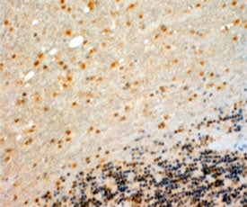 IHC testing of FFPE human cerebellum with CYP26B1 antibody at 4ug/ml. HIER: steamed with pH9 Tris/ED