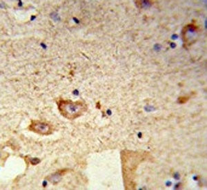 IHC testing of FFPE human brain tissue with Destrin antibody. HIER: steam section in pH6 citrate buf