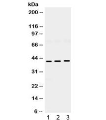 Western blot testing of 1) rat brain, 2) mouse brain and 3) human U87 lysate with HuD antibody. Expe