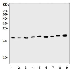 Western blot testing of rat 1) spleen, 2) brain, 3) thymus, 4) kidney and mouse 5) spleen, 6) kidney