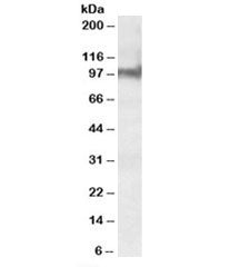 Plakophilin 2 Antibody