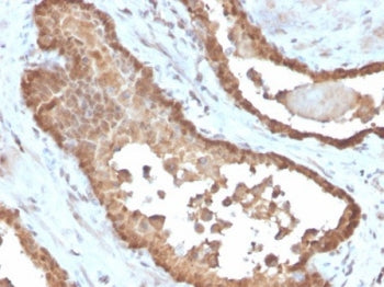 MIF Antibody / Macrophage migration inhibitory factor