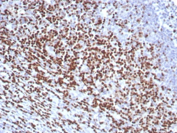 IHC staining of FFPE human tonsil tissue with LEF1 antibody (clone rLEF1/8854). HIER: boil tissue se