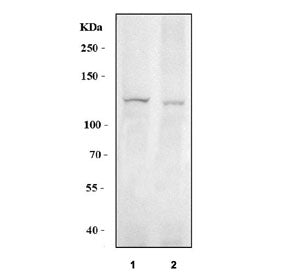 Western blot testing of human 1) PC-3 and 2) U-87 MG cell lysate with BK channel antibody. Predicted