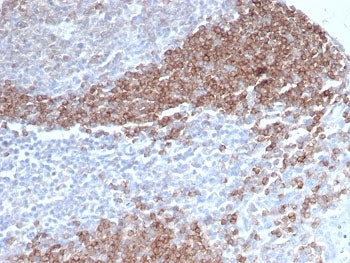 IHC staining of FFPE human tonsil tissue with CD79b antibody (clone CD79b/4960). HIER: boil tissue s