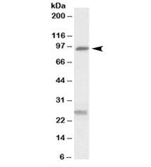 SLC4A11 Antibody