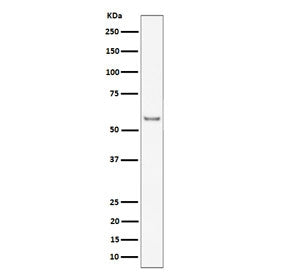 Western blot testing of mouse heart tissue lysate with Intercellular adhesion molecule 2 antibody. E