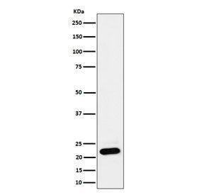 NDUFB9 Antibody