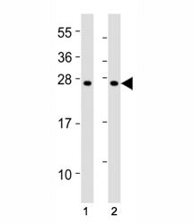 Western blot testing of SOCS1 antibody at 1:2000 dilution. Lane 1: mouse thymus lysate; 2: rat splee