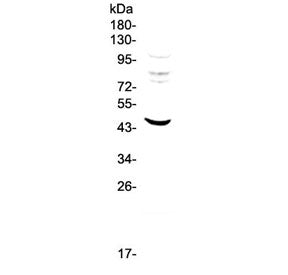 MVD Antibody / Mevalonate pyrophosphate decarboxylase