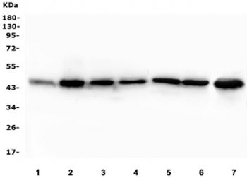 Western blot testing of human 1) placenta 2) HEK293, 3) A549, 4) HepG2, 5) U-87 MG, 6) PC-3 and 7) K