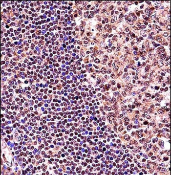 TCF3 Antibody / Transcription factor E2-alpha