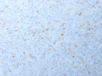 MMP3 Antibody / Matrix Metalloproteinase 3