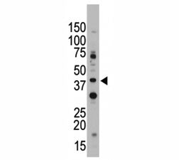 CD33 Antibody