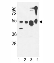 ATG13 antibody western blot analysis in 1) MDA-MB435,2) CEM, 3) T47D cell line and 4) mouse cerebell