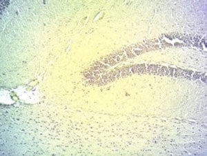 DIO2 Antibody