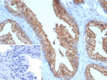 TMPRSS2 Antibody