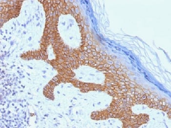 IHC testing of FFPE human skin with Desmoglein 3 antibody (clone DSG3/1535). Required HIER: boil tis