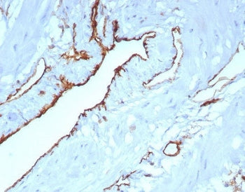 IHC staining of FFPE human uterus tissue with CD31 antibody (clone C31/8242R). HIER: boil tissue sec
