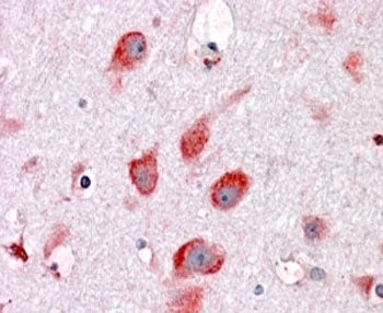 RPL22 Antibody