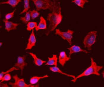 Immunofluorescent staining of FFPE human HeLa cells with PEPC antibody (red) and DAPI nuclear stain 