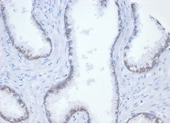 IHC staining of FFPE human tonsil tissue with recombinant Catenin Beta antibody (clone rCTNNB1/7358)